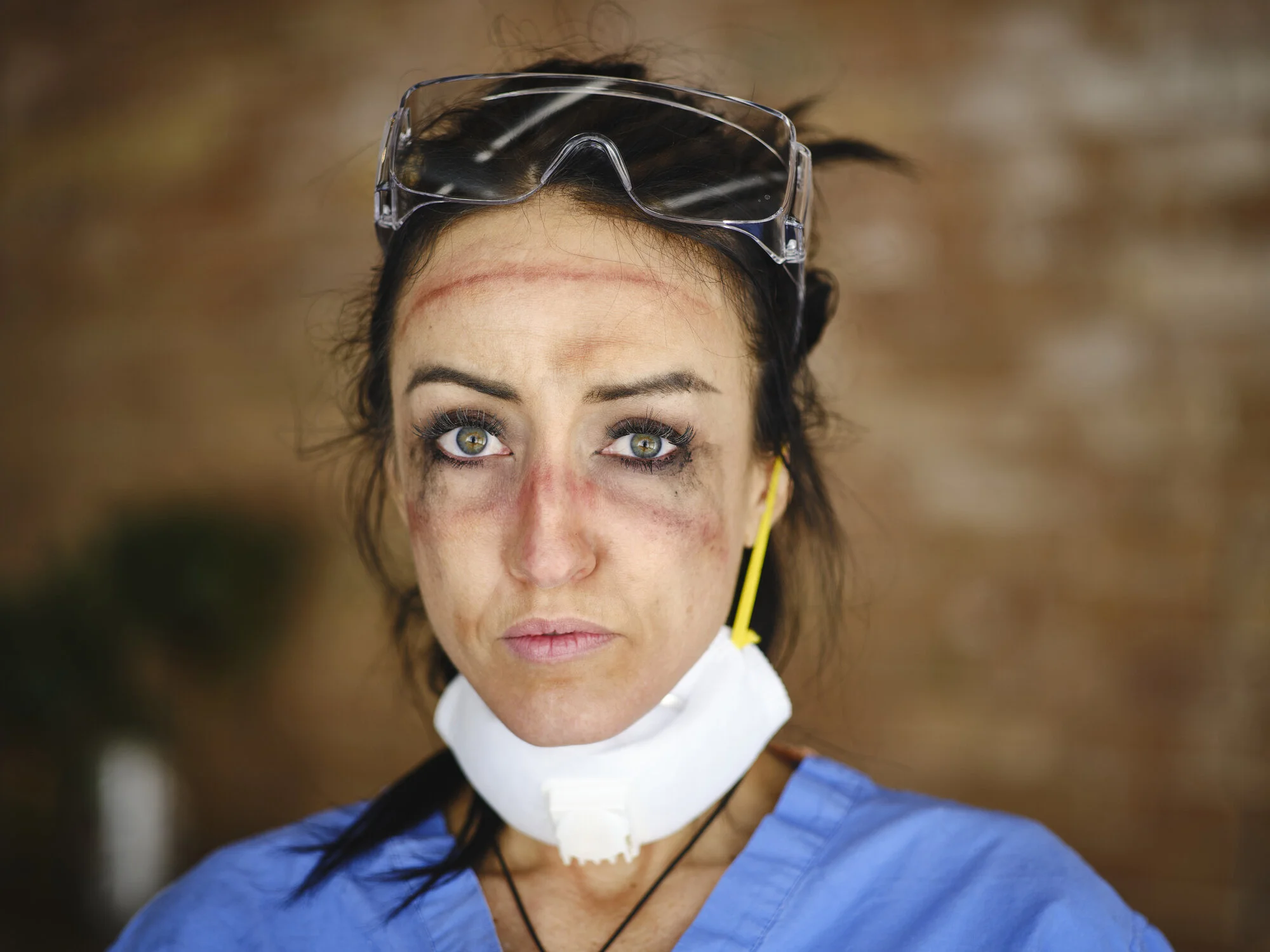 Close-up of a fatigued female healthcare worker with protective goggles, facial marks, and a mask around her neck.