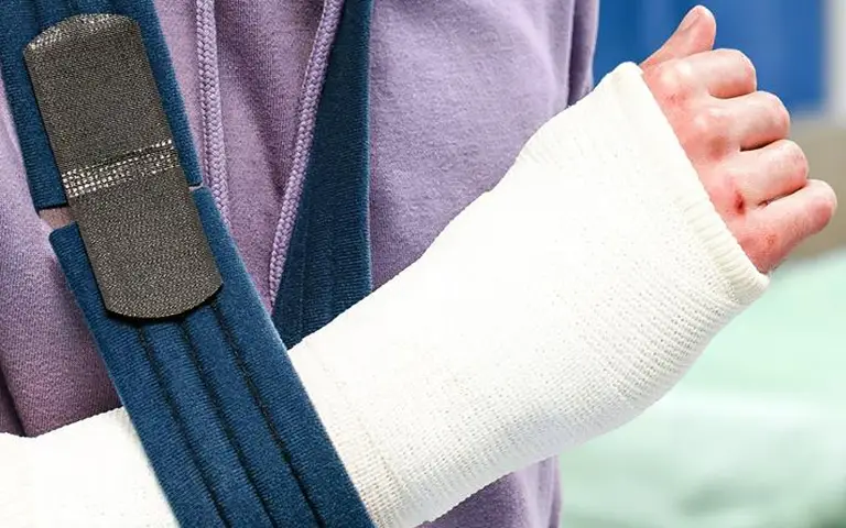 Close-up of a person wearing a purple top with a white arm cast and blue arm sling.